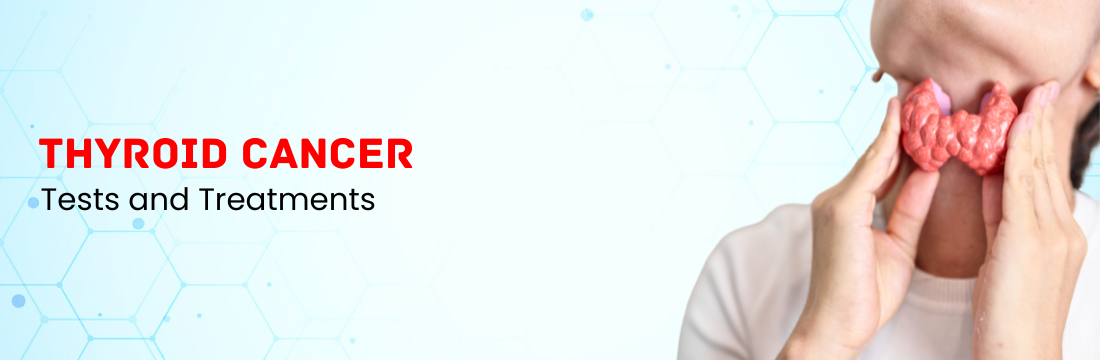 Tests and Treatments for Thyroid Cancer